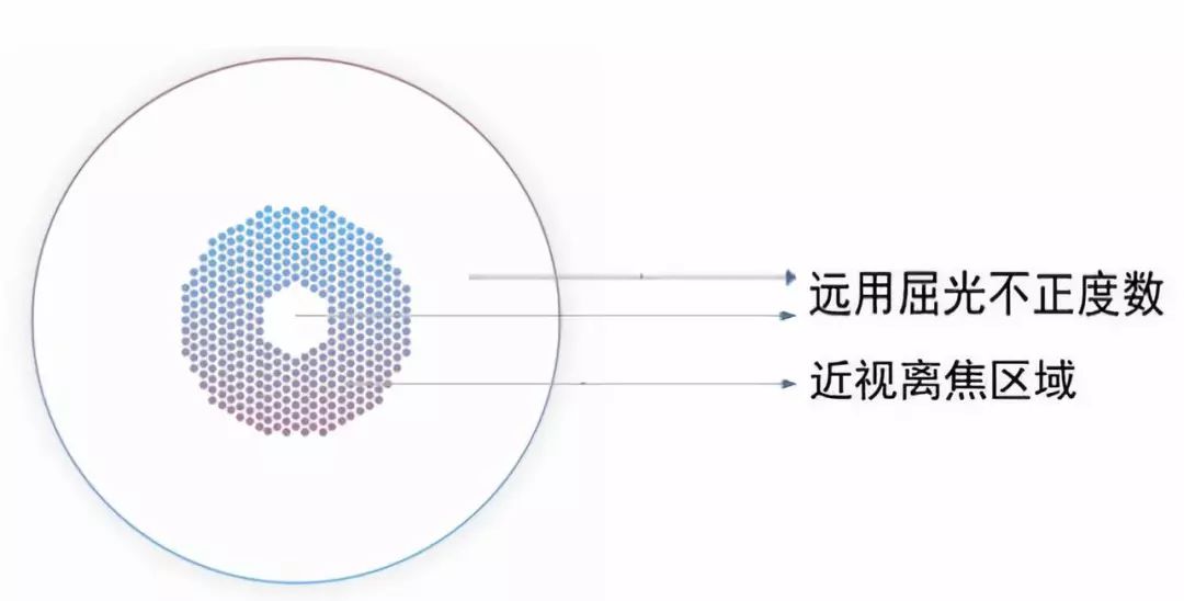 原理豪雅新乐学多点近视离焦镜片(简称新乐学镜片)采用多区正向光学离