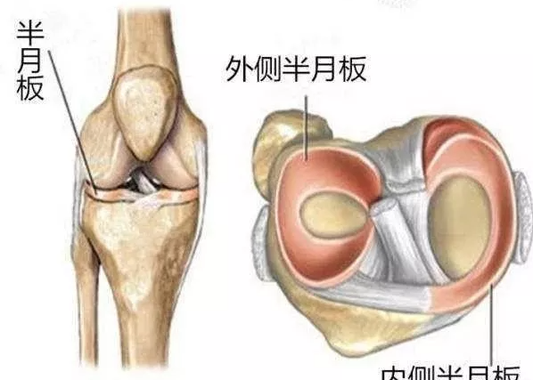 而我们膝关节半月板又分为两部分,分别为内侧半月板和外侧半月板!