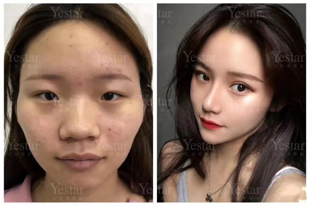 美眼后多了几分混血感    眉眼间距 有些人的宽双眼皮看着怪怪的