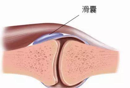 滑膜炎诊断证明书图片