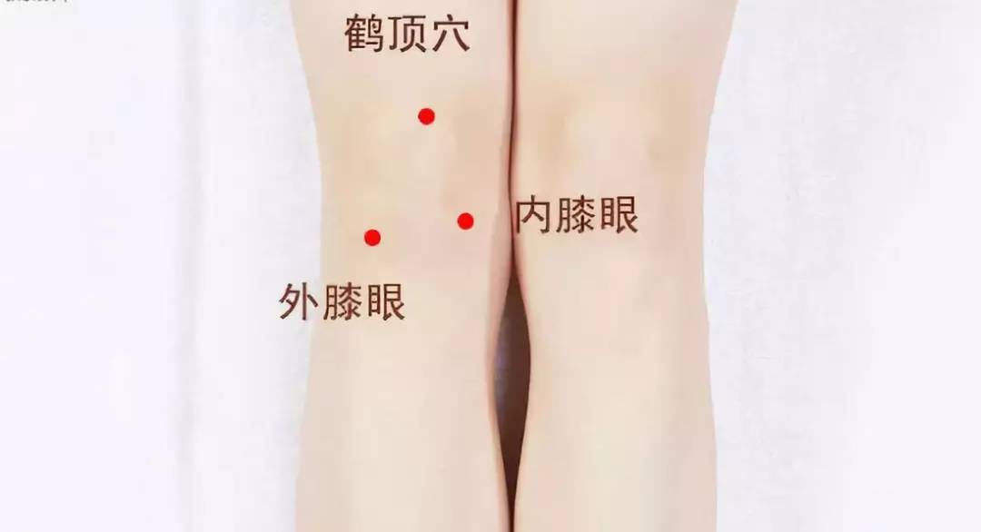 功效:常按此穴可以治疗足胫无力,膝关节炎,瘫痪,膝关节酸痛,鹤膝风等