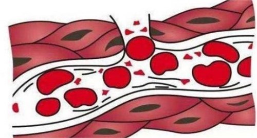 血流变检查主要是通过观测血液的相关粘度,流动,凝集等流变性和红细胞
