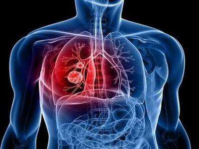 心肺功能下降该怎么办?呼吸康复操了解一下-齐鲁晚报网