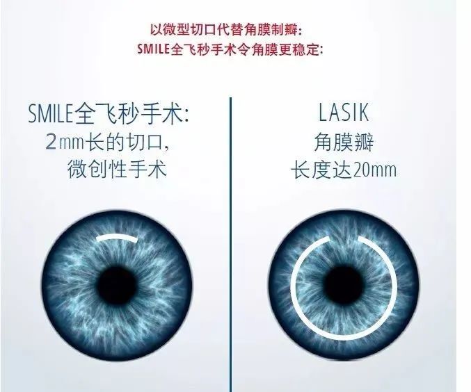 "半飞秒"vs"全飞秒" 形相似但质不同