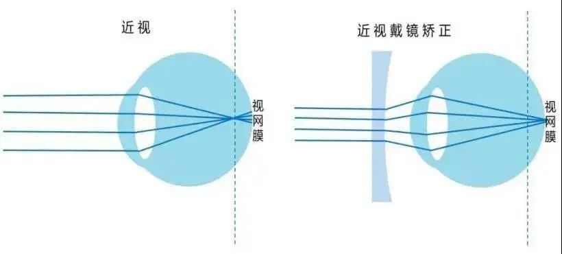 眼睛光路图图片