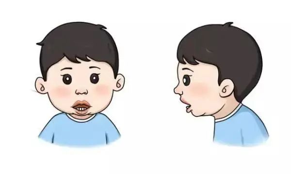 当孩子出现吮指,用手摸牙,咬笔头,吐舌,手托腮,偏侧咀嚼等习惯,家长们