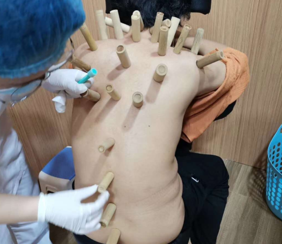 探秘中医非遗⑥丨竹罐下的血色诊断书