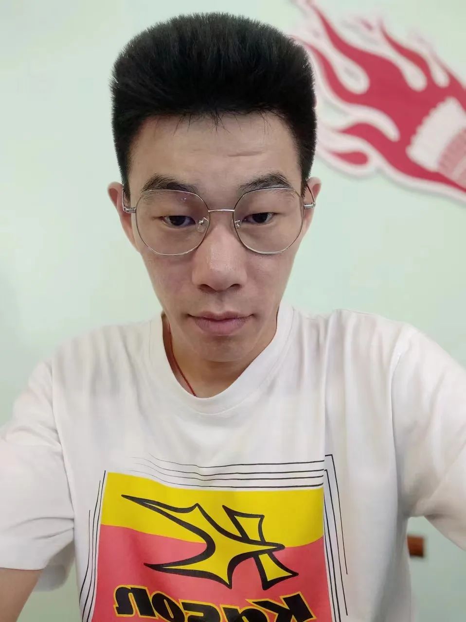 【聊城爱尔】羽毛球教练摘镜记！