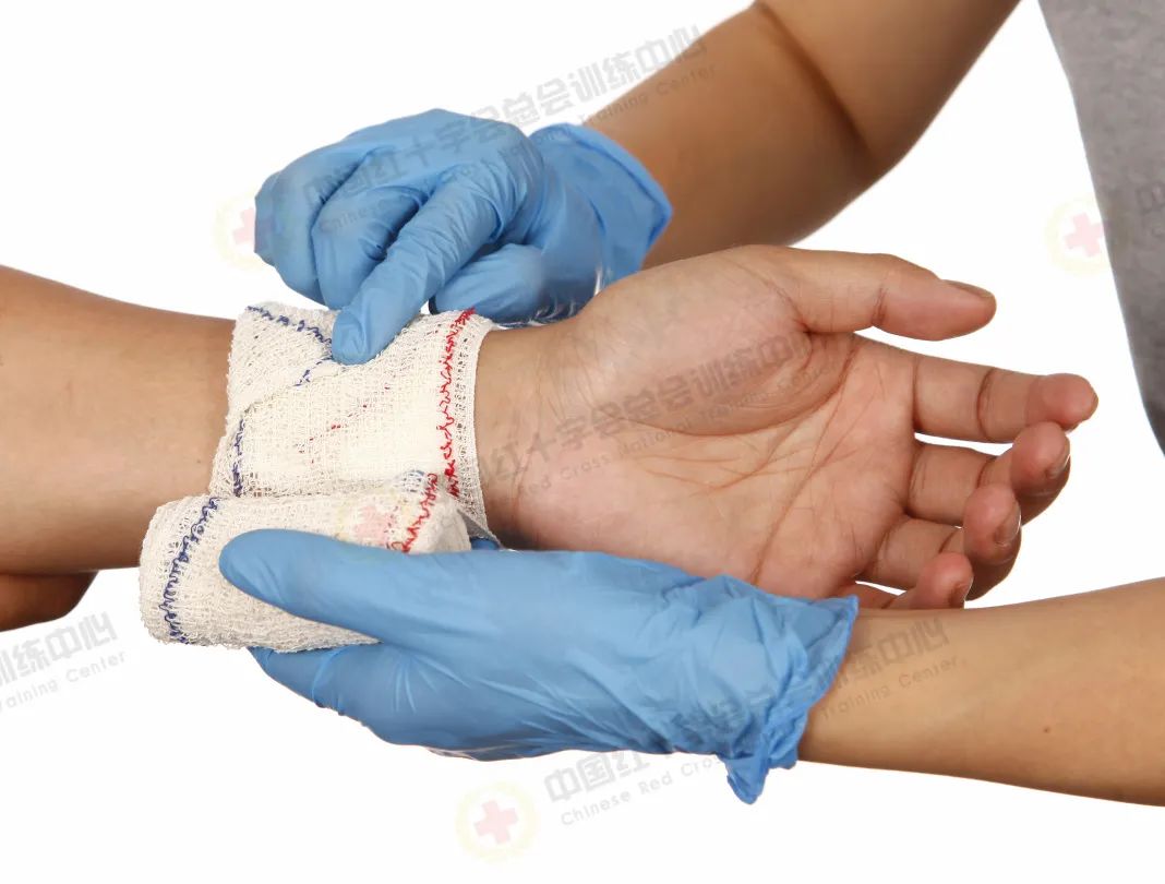 应急救护科普|现场包扎技术之绷带螺旋反折包扎-齐鲁晚报·齐鲁壹点