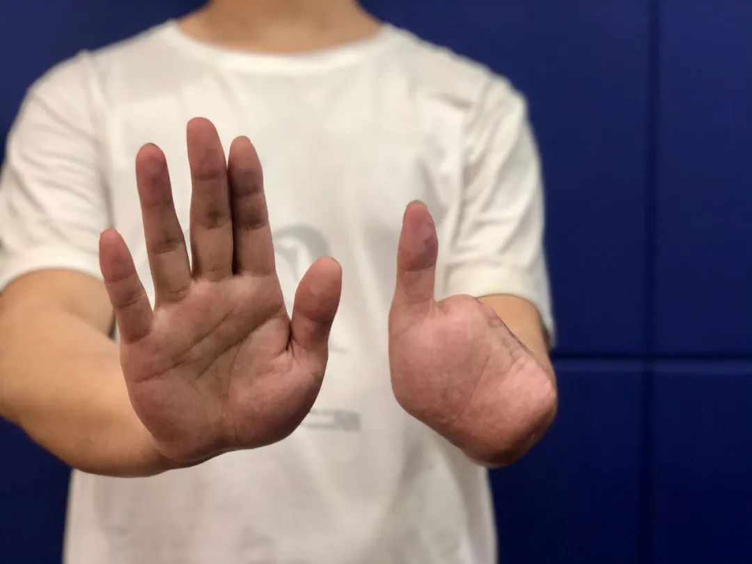 吃狗食,手指被剁……-齐鲁晚报网