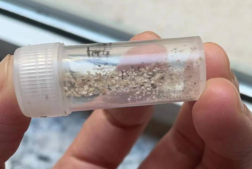 14岁女孩身患7毫米结石,罪魁祸首竟然是…-齐鲁晚报·齐鲁壹点