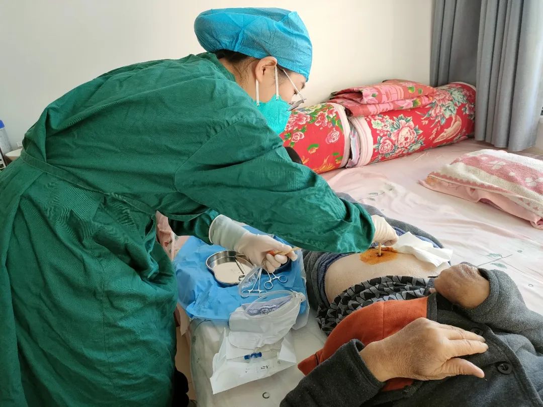 宁津县中医院:八旬老人更换膀胱造瘘管,护士上门解烦忧