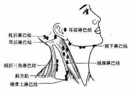 脖子淋巴疼痛的位置图图片
