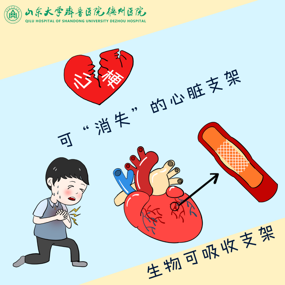 山东大学齐鲁医院德州医院成功开展冠状动脉生物可吸收支架置入术