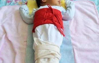 医在身边|孩子腿纹不对称怎么办？髋关节超声热点知识全在这里了