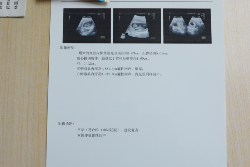 怀孕诊断报告图片