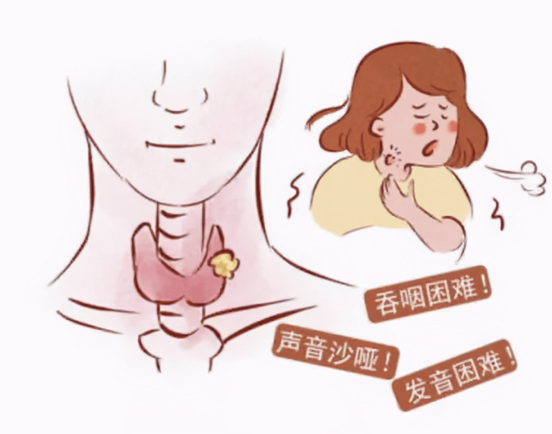 患上甲状腺结节,饮食和碘盐应该如何选择?