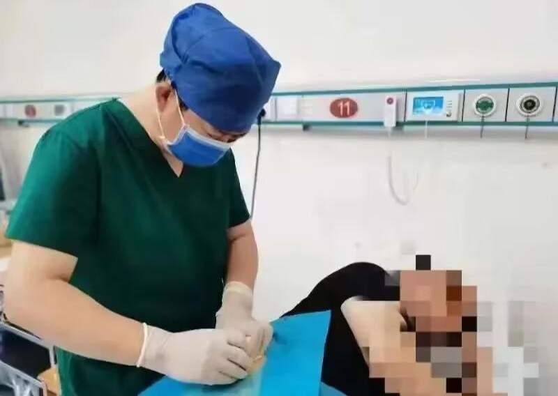 淄博市中西医结合医院小针刀5分钟治疗腱鞘炎弹响指