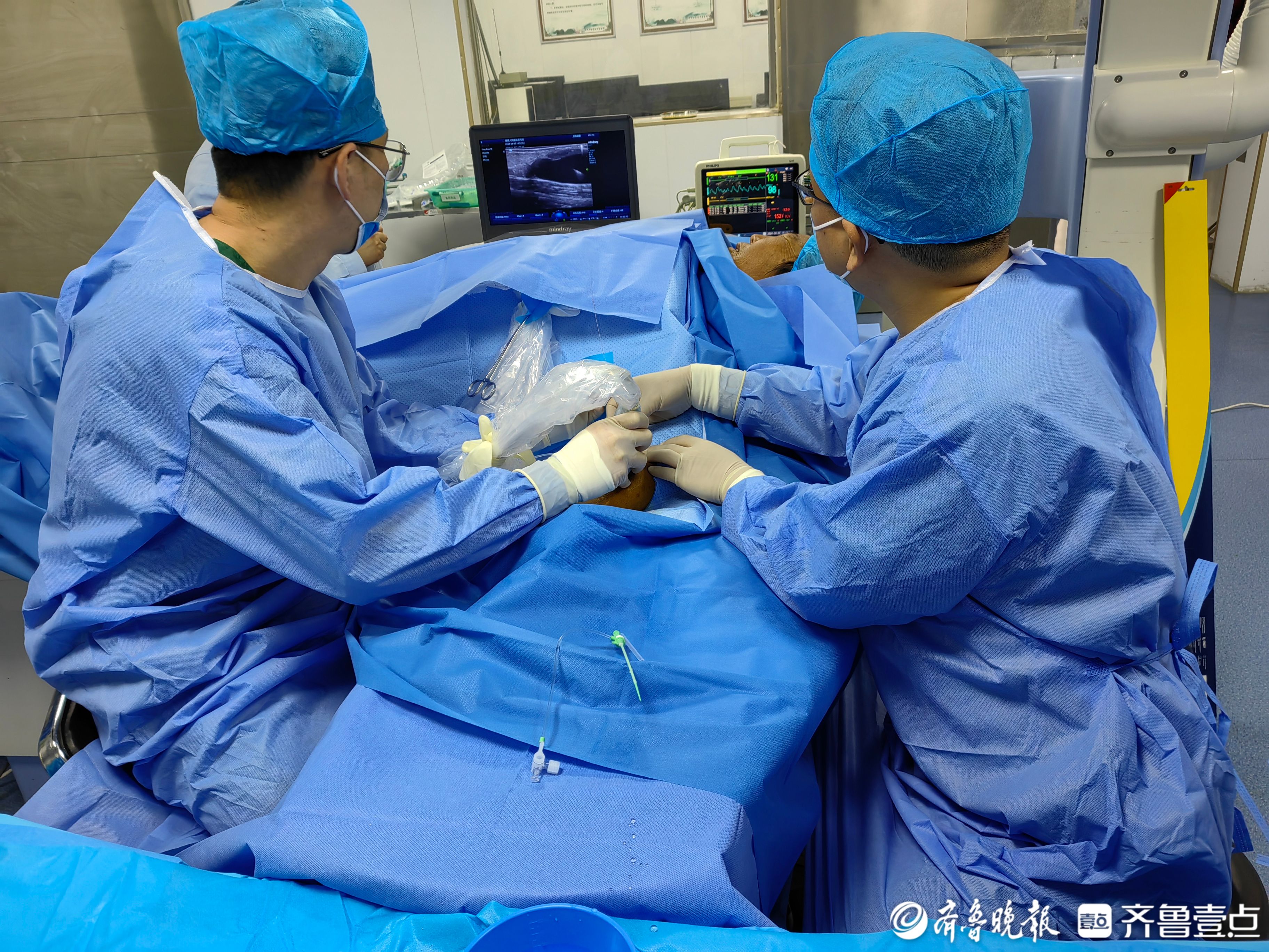 牡丹区中医医院成功开展动静脉内瘘球囊扩张术