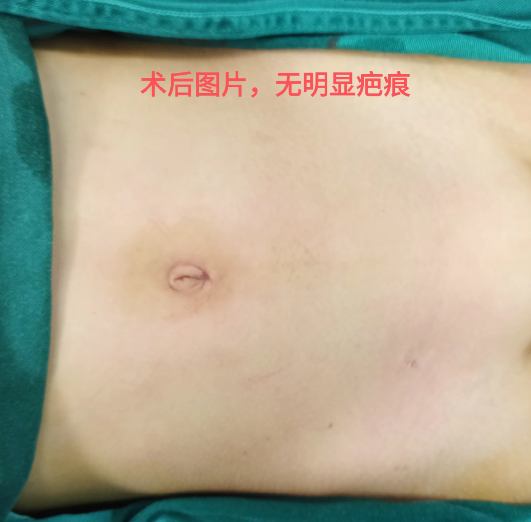 怎么制造手术钩针西藏→潍坊 这是跨越4000公里的信任_https://www.jmylbn.com_新闻资讯_第3张