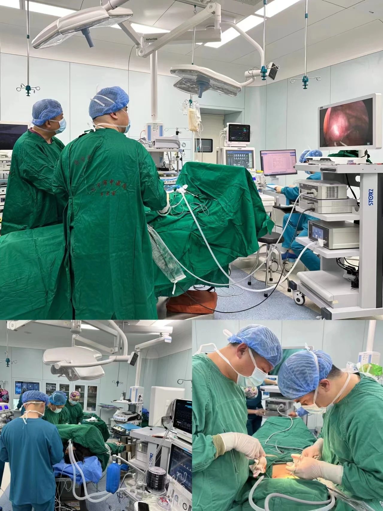 术后病理显示:胆囊结石并急性坏疽性胆囊炎.