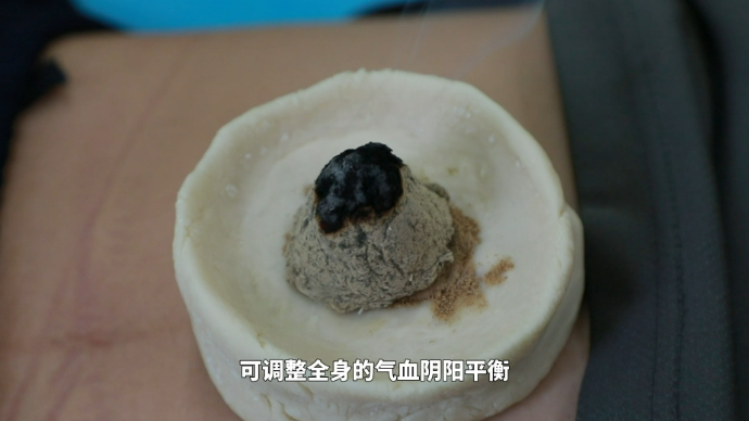 “灸”养生|小面团大作用！治疗成人脾胃疾病可以了解下脐灸