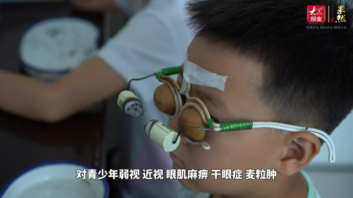 “灸”养生|核桃+眼镜框组成中医护眼小妙招