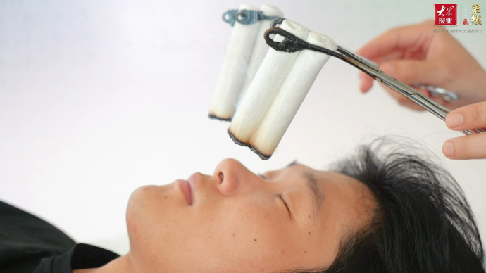 “灸”养生|buff叠满！治疗过敏性鼻炎，快抓住三伏天的尾巴