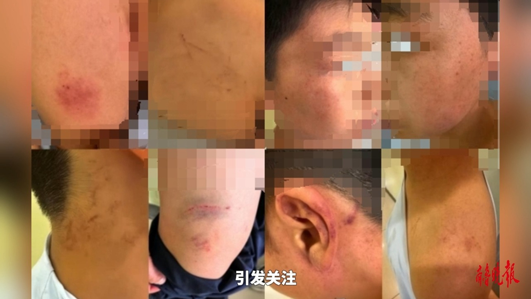果然视频|天津10岁儿童疑遭培训机构老师殴打，警方已介入调查