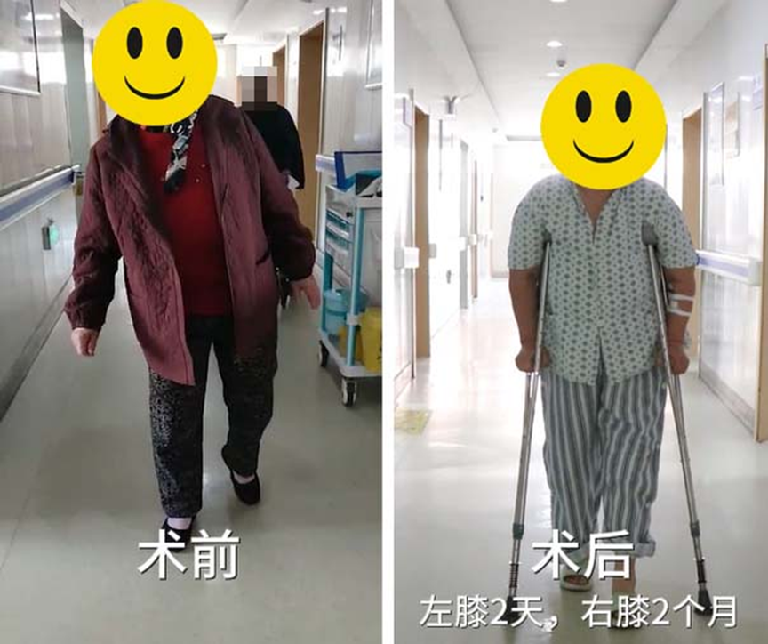 精准手术，创伤更小，骨科机器人换膝关节疼痛敏感人群的福音