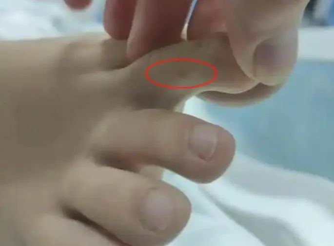 三亚多个小区投放驱蛇药，物业：是常规操作