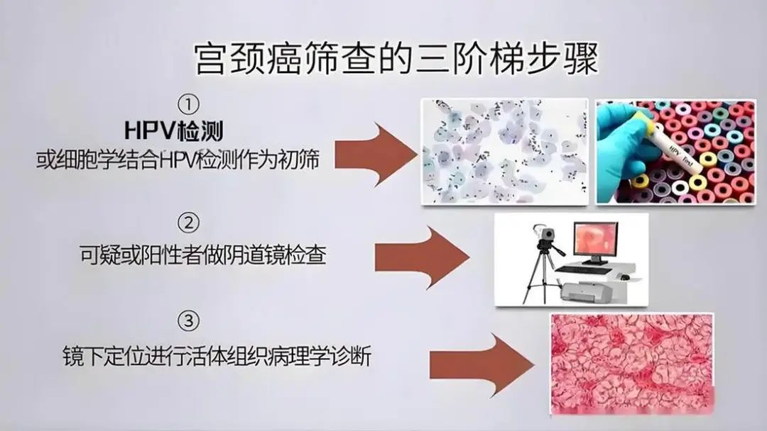 关于HPV，你想知道的这里都有