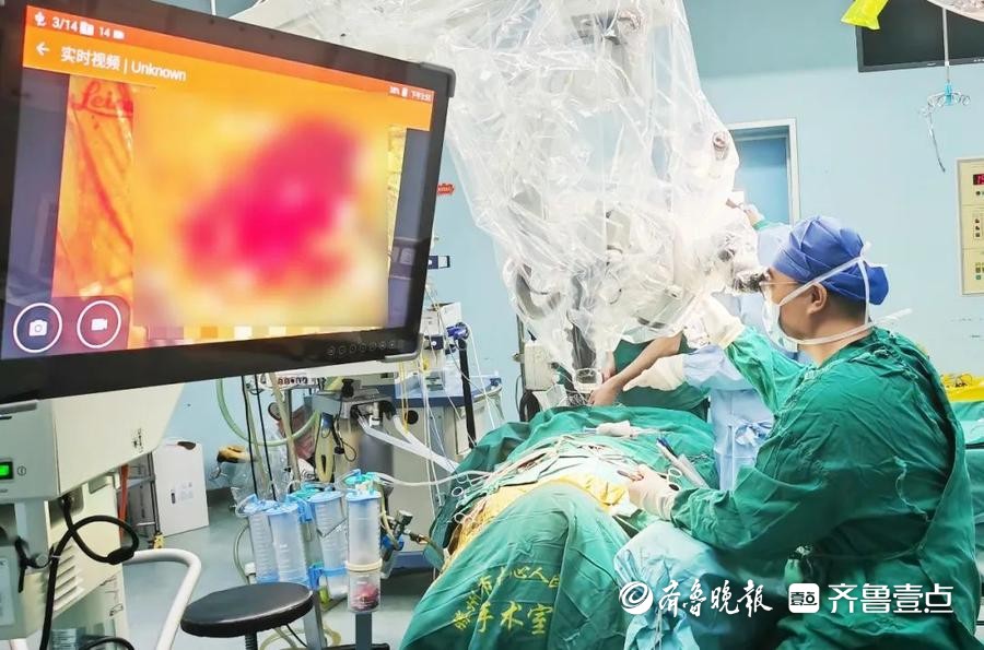 滕州市中心人民医院神经外科二病区成功实施颈深淋巴-静脉吻合术