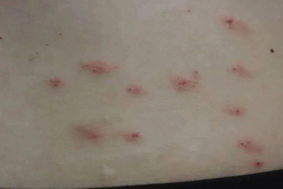 图片加载失败