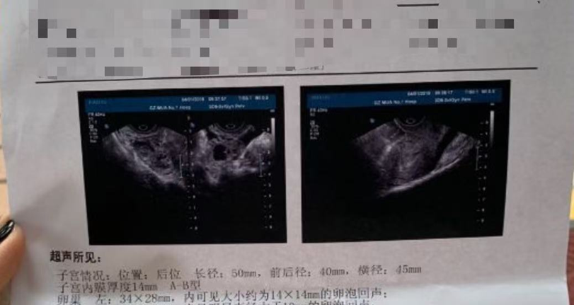 千里求医终圆梦湖南不孕患者济南嘉乐生殖医院成功手术获新生  