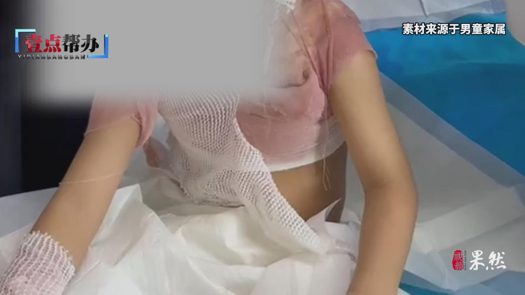 壹点帮办|幼儿园热水桶坠落致青岛6岁娃烫伤，后续治疗谁买单？