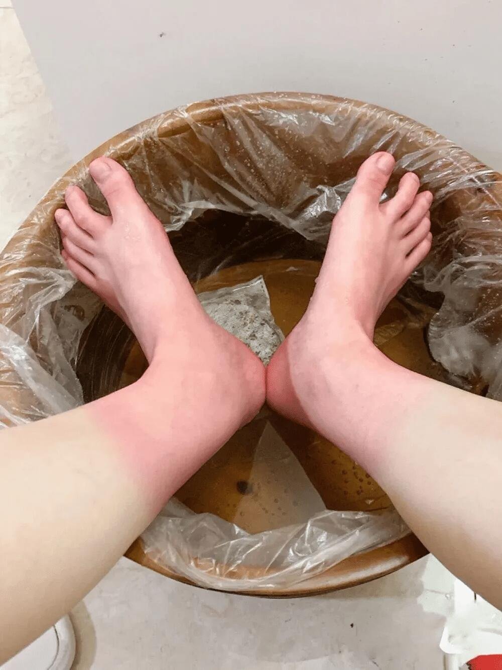  神奇！中药足浴改善鼻炎症状，三伏天是最佳时机