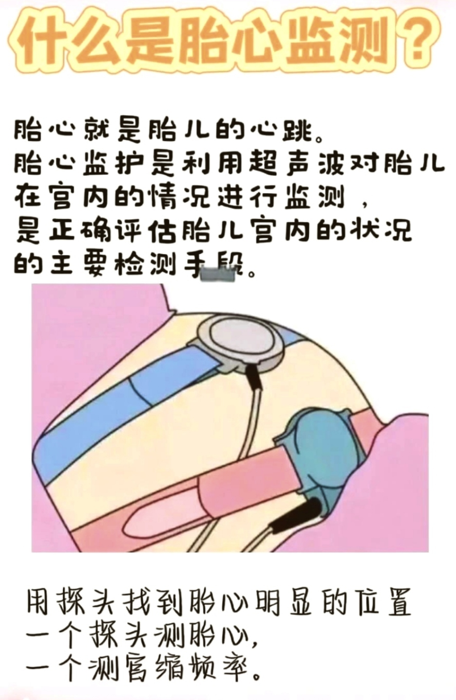 健康科普 | OCT试验是咋回事？孕妈妈们看过来