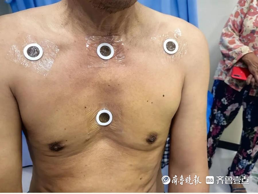 滕州市康复医院邾城院区三伏贴贴敷正当时，中医特色疗法受青睐