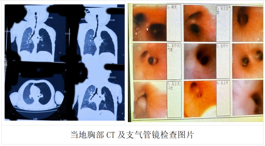 跨越千里的生命接力！山东大学附属儿童医院成功救治疑难重症患儿