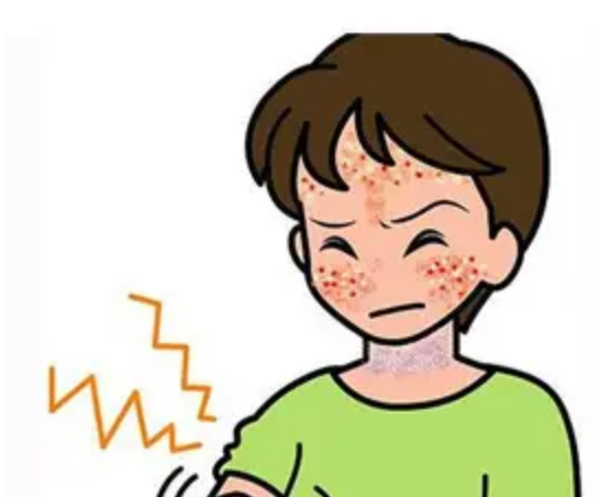 夏日光敏性皮炎，如何科学用药？