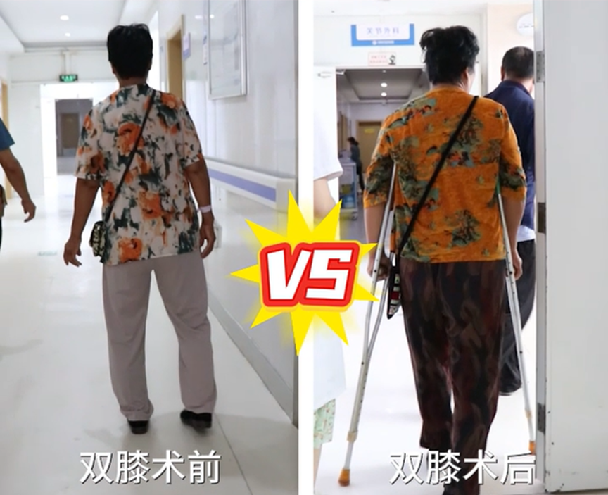 机器人助力膝关节炎患者快速康复，济南关节外科医院不负二次信任