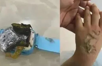 突发自燃！快检查你家宝贝的电话手表！