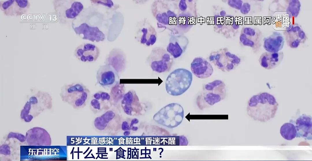 一月两起“食脑虫”夺命悲剧，玩水如何避开致命威胁？