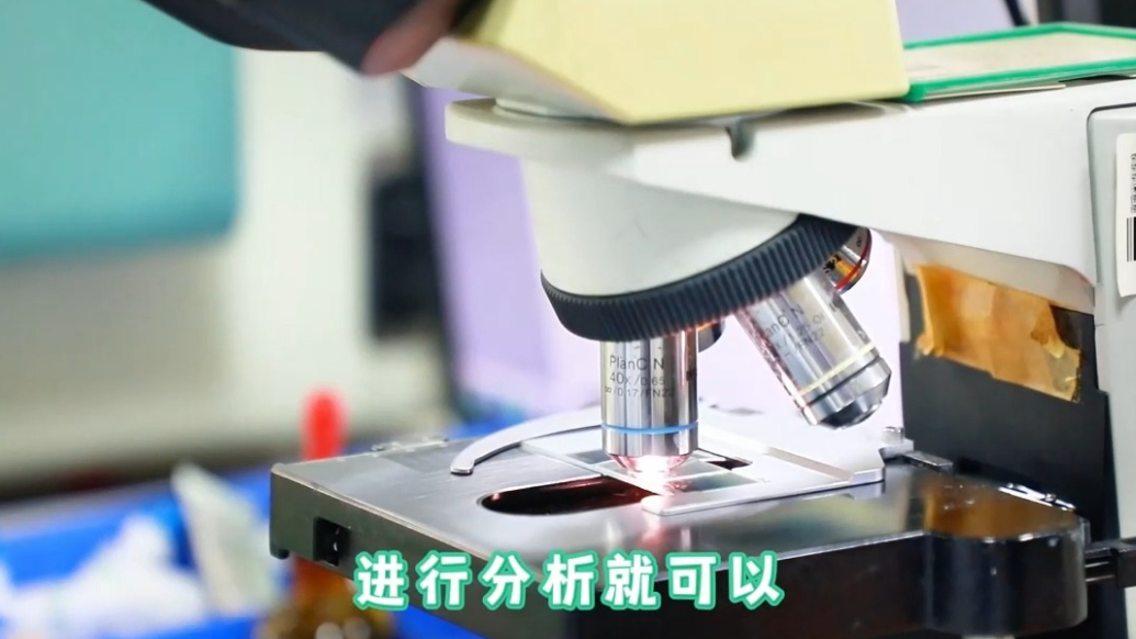 红绘医生说丨为什么检查输卵管前要先检查男方精液？