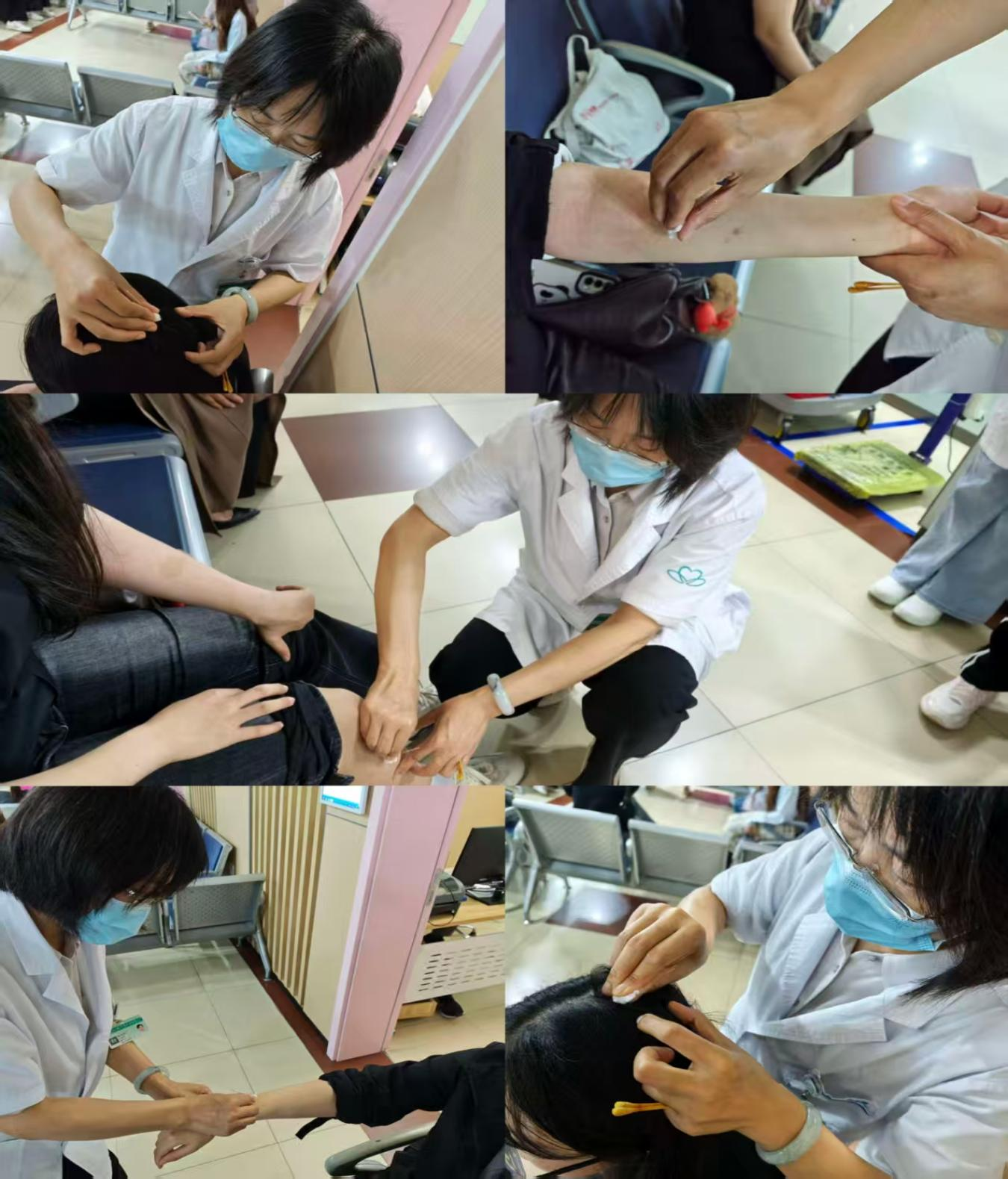 一根银针，重塑身心平衡——临沂市人民医院平衡针灸门诊开诊