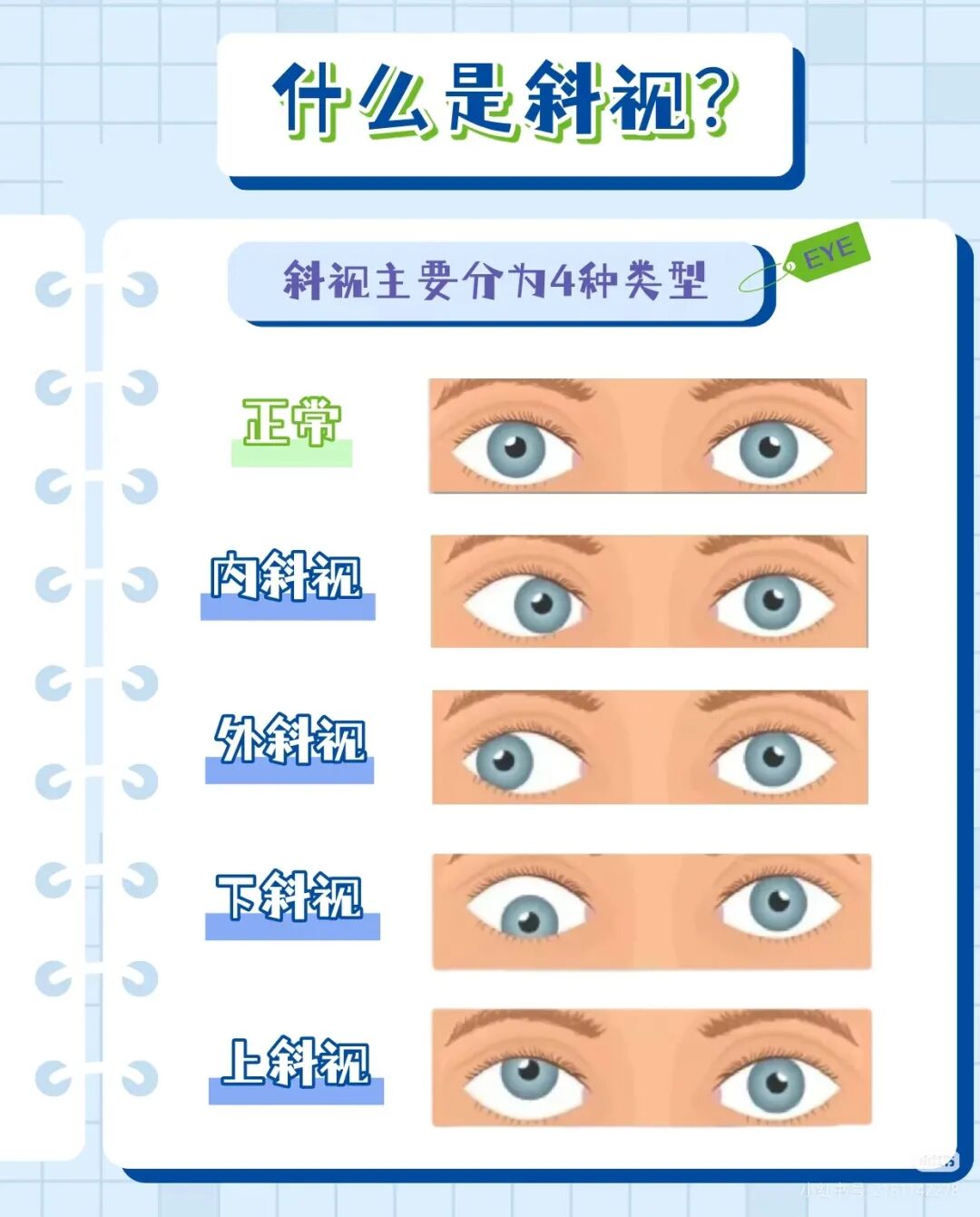 济南市眼科医院科普|斜视的危害和治疗方法