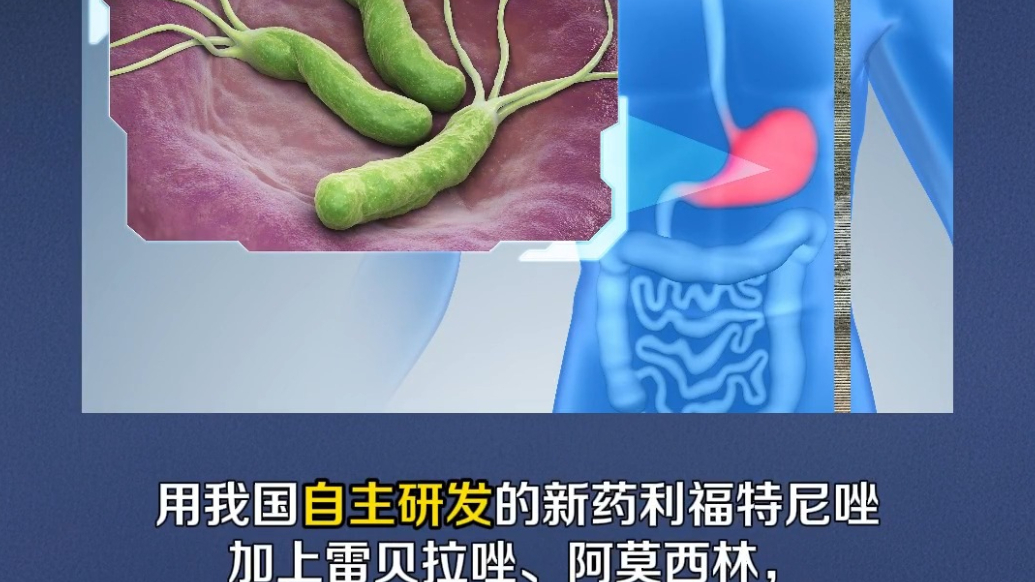 幽门螺杆菌治疗“减药”了！我国科学家新方案让四联变三联