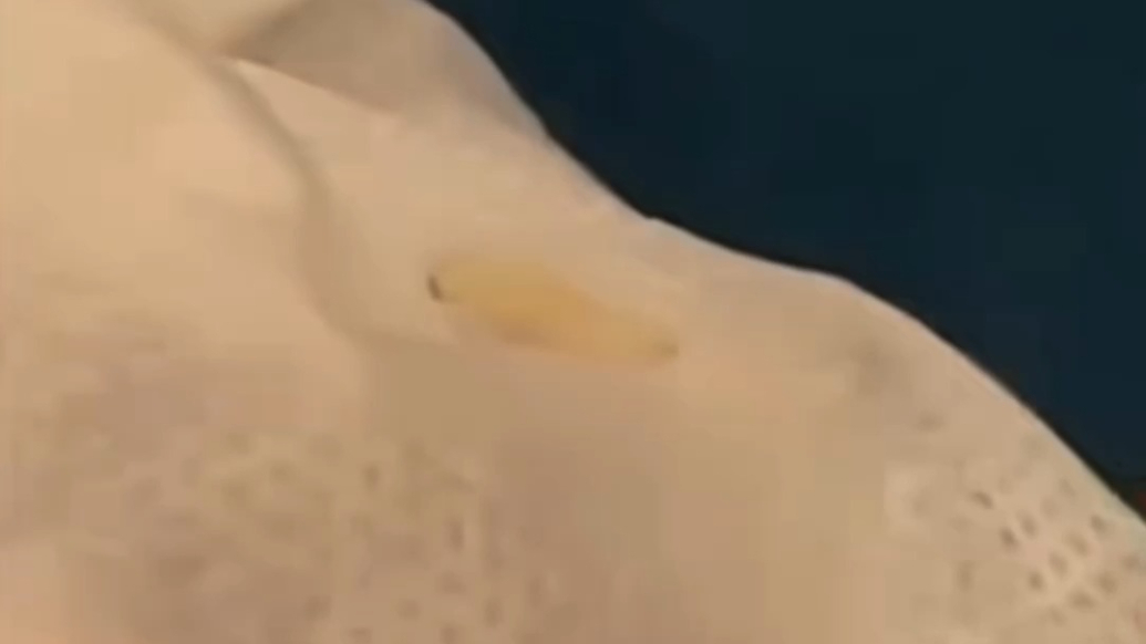 苏菲安心裤现活虫！郑州妈妈崩溃，现场拆新卫生巾再次发现活虫