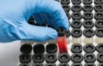 四川平武回应集中采集血样：覆盖全县男性，属于再次核对采集